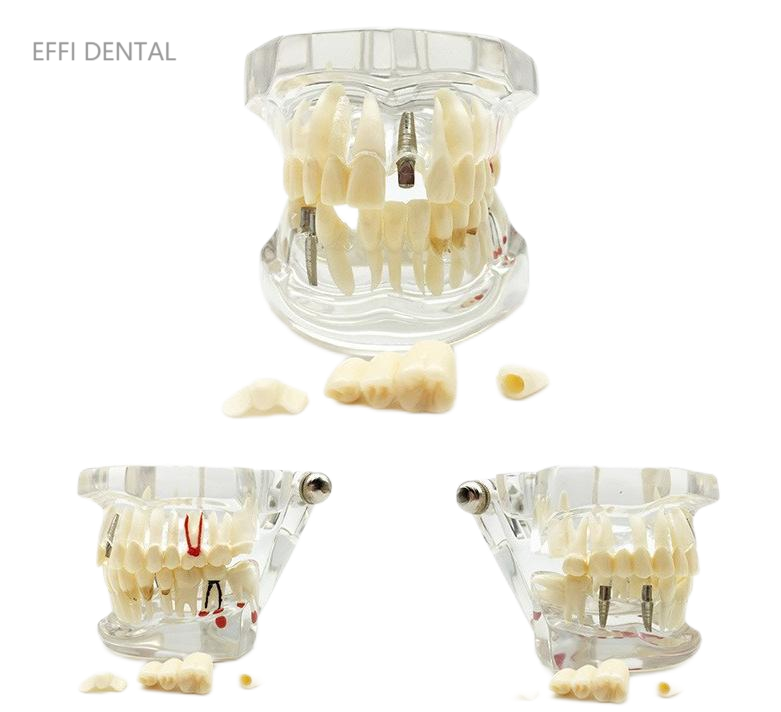  Dental Models 