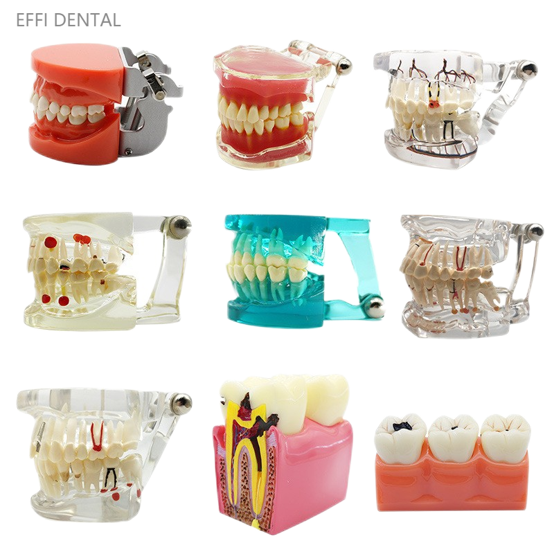  Dental Models 