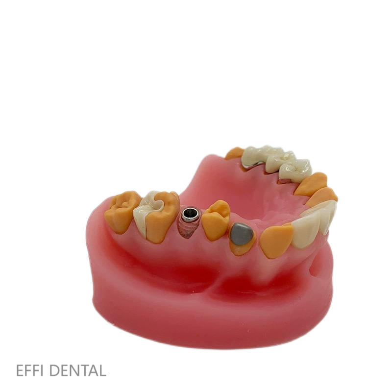 Dental prosthesis display model