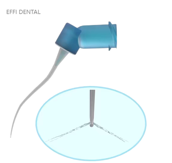 Dental irrigating needle